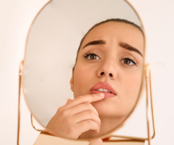 Come si riconosce l’herpes e come trattarlo.