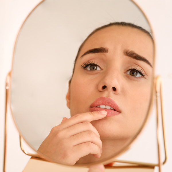 Come si riconosce l’herpes e come trattarlo.