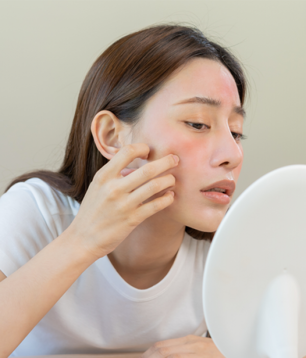 Sai riconoscere e trattare la dermatite?