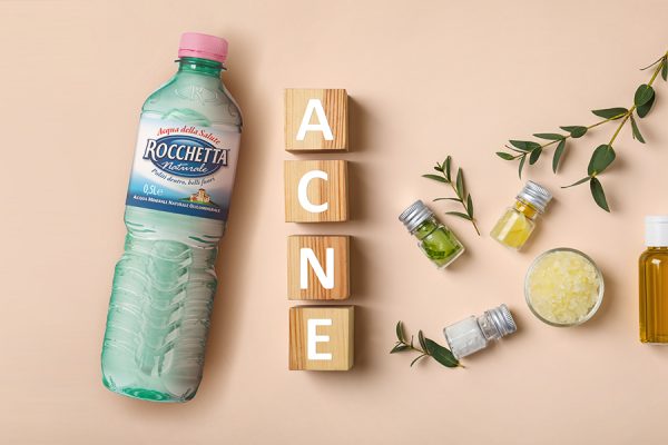 Acne e alimentazione: 10 consigli utili