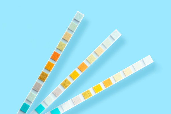 Se il colore delle urine cambia devo consultare il medico?