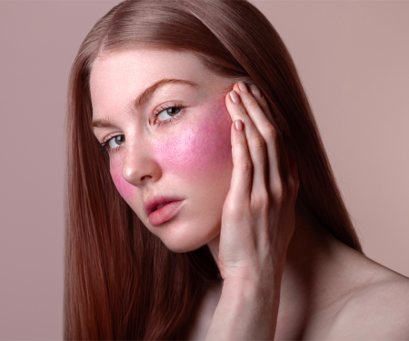 Come la couperose peggiora in inverno