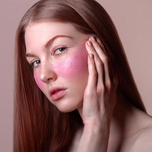 Come la couperose peggiora in inverno