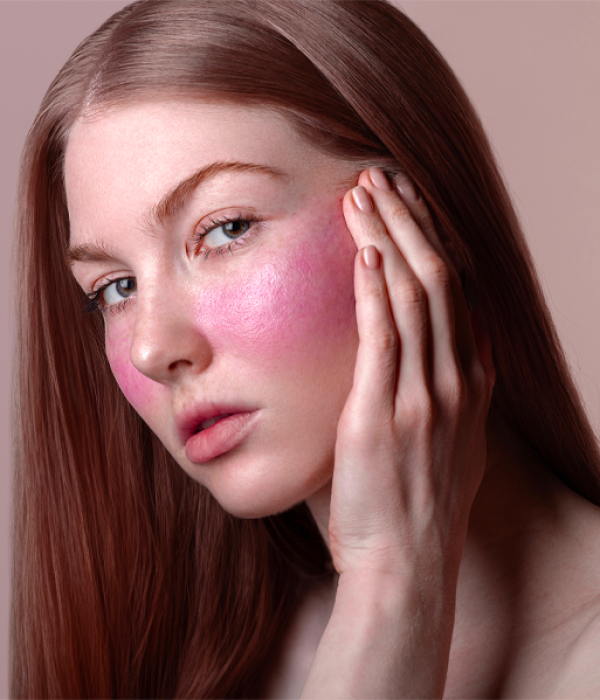 Come la couperose peggiora in inverno