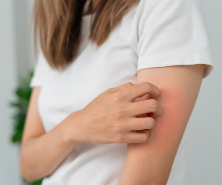 Allergia al nichel: sintomi, cause e prevenzione
