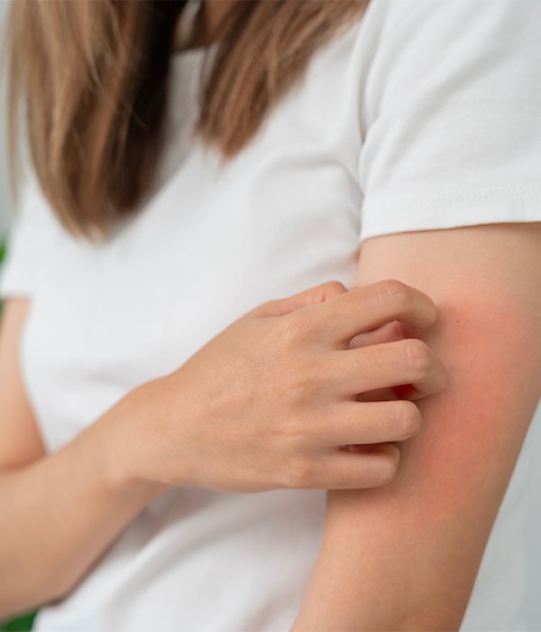 Allergia al nichel: sintomi, cause e prevenzione